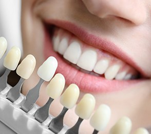 Teeth being compared to a shade guide