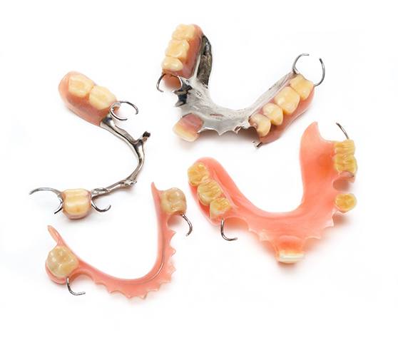 The types of dentures in Austin
