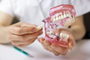 Dentist holding a model of a dental bridge. 